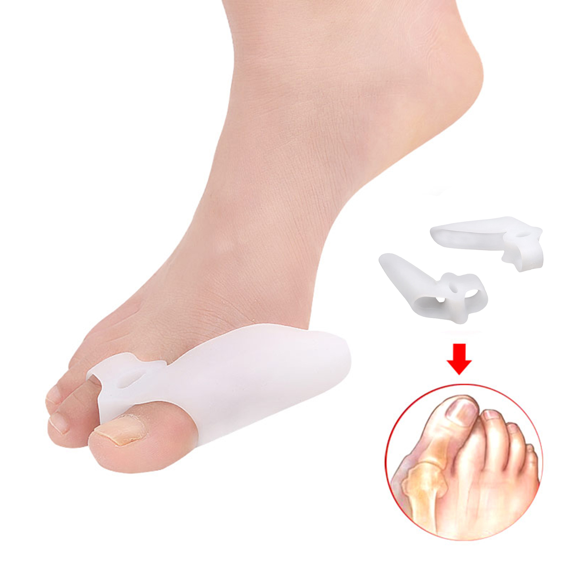 best bunion toe corrector