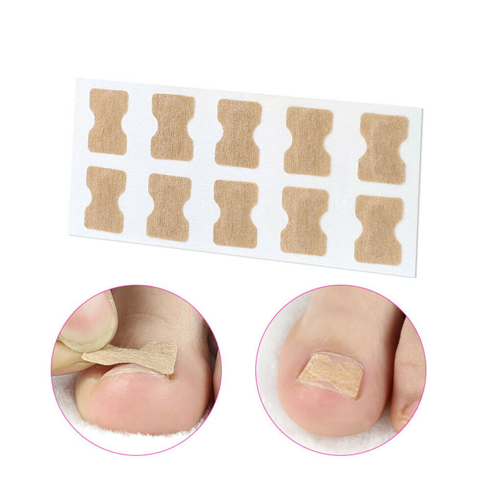 Patch ongle incarné mincir