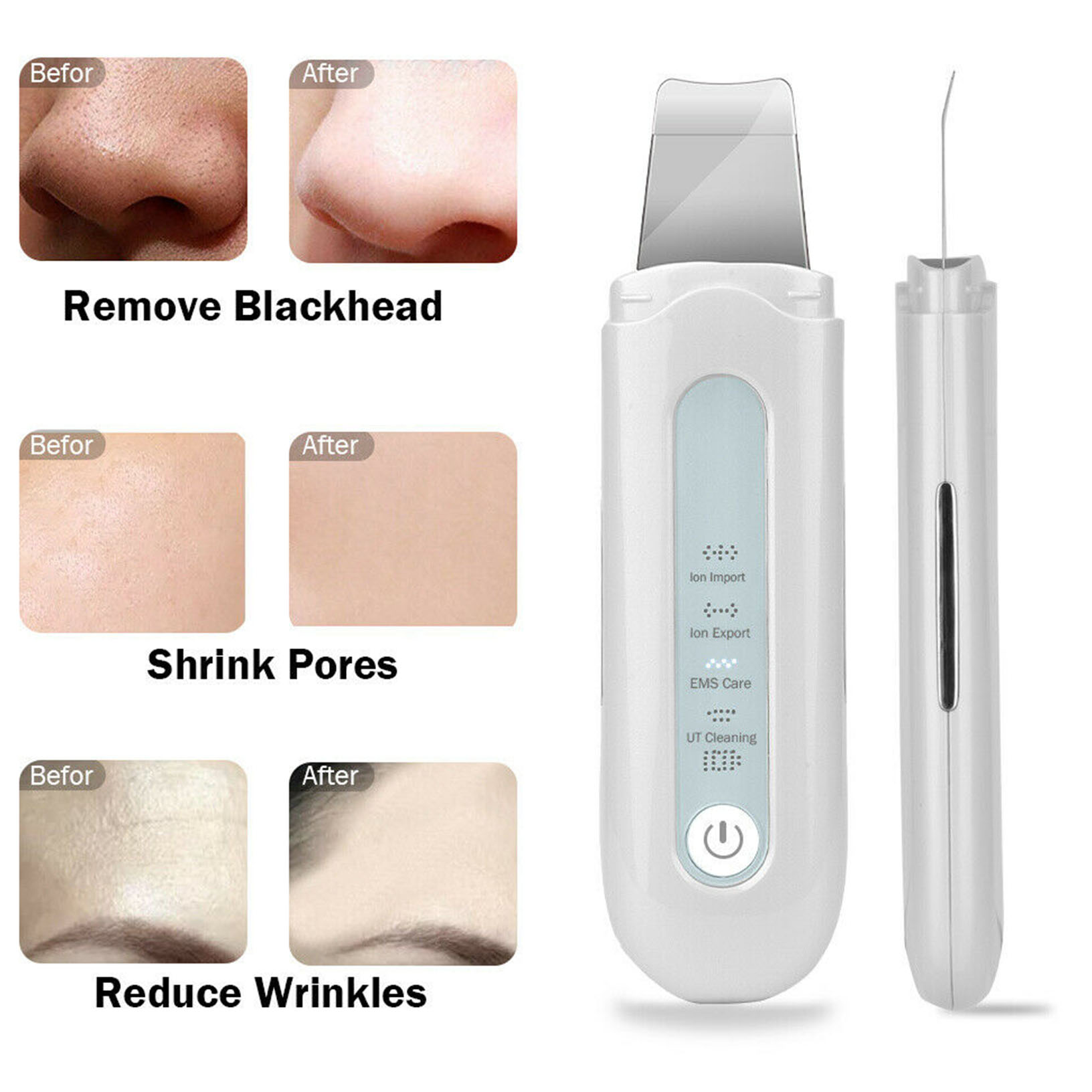 Deep Cleaner Tool Facial Ultrasonic Skin Scrubber Spatula Face Extractor Peeling Ebay
